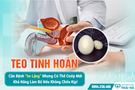 Teo Tinh Hoàn – Căn Bệnh “Im Lặng” Nhưng Có Thể Cướp Mất Khả Năng Làm Bố Nếu Không Chữa Kịp!