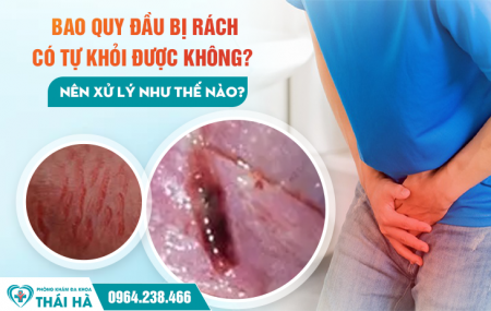 Bao Quy Đầu Bị Rách Có Tự Khỏi Được Không? Nên Xử Lý Như Thế Nào?