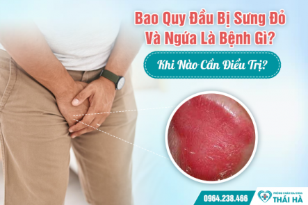 Bao Quy Đầu Bị Sưng Đỏ Và Ngứa Là Bệnh Gì? Khi Nào Cần Điều Trị?