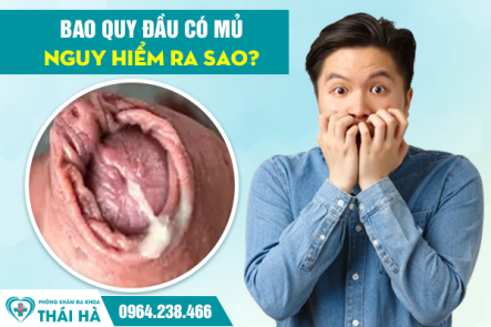 Bao Quy Đầu Có Mủ Nguy Hiểm Ra Sao?
