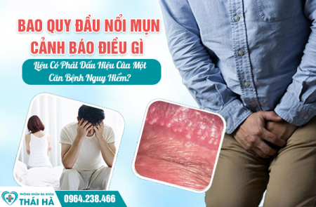 Bao Quy Đầu Nổi Mụn Cảnh Báo Điều Gì – Liệu Có Phải Dấu Hiệu Của Một Căn Bệnh Nguy Hiểm?