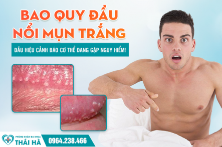 Bao Quy Đầu Nổi Mụn Trắng: Dấu Hiệu Cảnh Báo Cơ Thể Đang Gặp Nguy Hiểm!