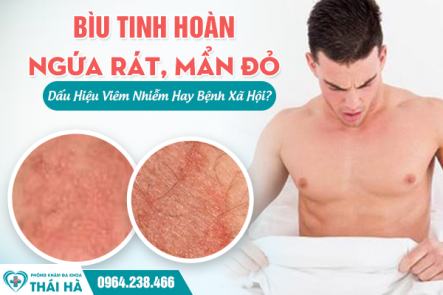 Bìu Tinh Hoàn Ngứa Rát, Mẩn Đỏ: Dấu Hiệu Viêm Nhiễm Hay Bệnh Xã Hội?