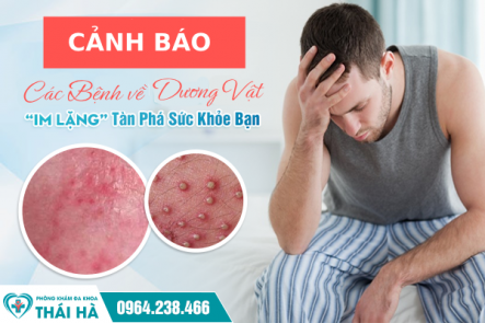 Cảnh báo - Các Bệnh về Dương Vật 