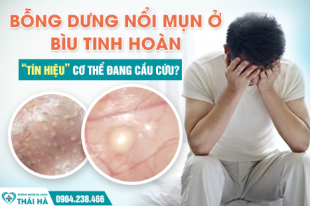 Bỗng Dưng Nổi Mụn Ở Bìu Tinh Hoàn: “Tín Hiệu” Cơ Thể Đang Cầu Cứu?
