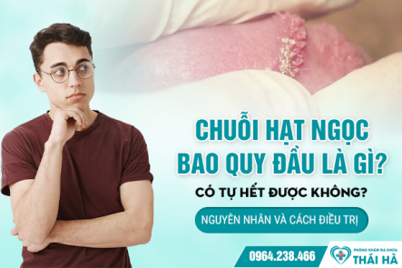 Chuỗi Hạt Ngọc Bao Quy Đầu Là Gì? Có Tự Hết Được Không? Nguyên Nhân Và Cách Điều Trị