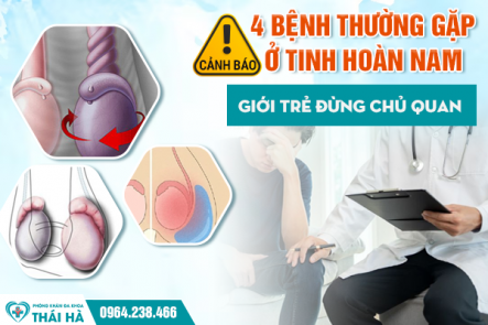 Cảnh Báo: 4 Bệnh Thường Gặp Ở Tinh Hoàn Nam - Giới Trẻ Đừng Chủ Quan