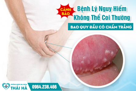 Cảnh Báo Bệnh Lý Nguy Hiểm Không Thể Coi Thường - Bao Quy Đầu Có Chấm Trắng 