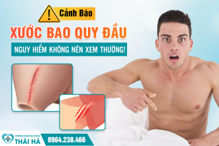 Cảnh Báo: Xước Bao Quy Đầu – Nguy Hiểm Không Nên Xem Thường!