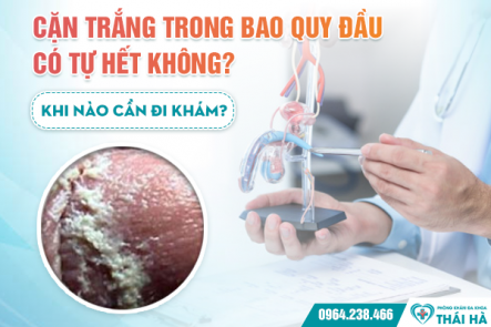 Cặn Trắng Trong Bao Quy Đầu Có Tự Hết Không? Khi Nào Cần Đi Khám?