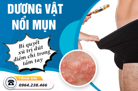 Dương Vật Nổi Mụn Là Bệnh Lý Gì? Nguyên Nhân Và Cách Chữa