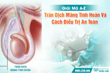 Giải Mã A-Z Tràn Dịch Màng Tinh Hoàn Và Cách Điều Trị An Toàn