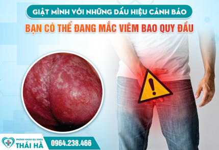Giật Mình Với Những Dấu Hiệu Cảnh Báo Bạn Có Thể Đang Mắc Viêm Bao Quy Đầu