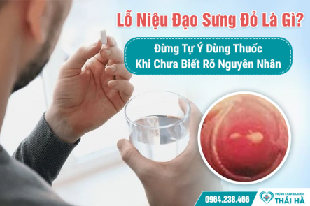 Lỗ Niệu Đạo Sưng Đỏ Là Gì? Đừng Tự Ý Dùng Thuốc Khi Chưa Biết Rõ Nguyên Nhân