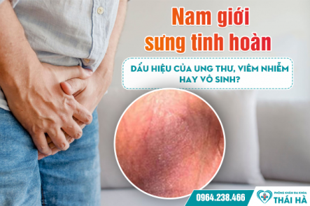 Nam giới sưng tinh hoàn: Dấu hiệu của ung thư, viêm nhiễm hay vô sinh?