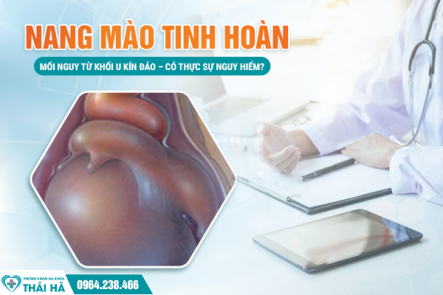 Nang Mào Tinh Hoàn: Mối Nguy Từ Khối U Kín Đáo – Có Thực Sự Nguy Hiểm?