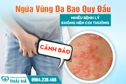 Ngứa Vùng Da Bao Quy Đầu – Cảnh Báo Nhiều Bệnh Lý Không Nên Coi Thường