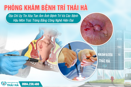 Phòng Khám Bệnh Trĩ Thái Hà: Địa Chỉ Uy Tín Xóa Tan Ám Ảnh Bệnh Trĩ Và Các Bệnh Hậu Môn Trực Tràng Bằng Công Nghệ Hiện Đại