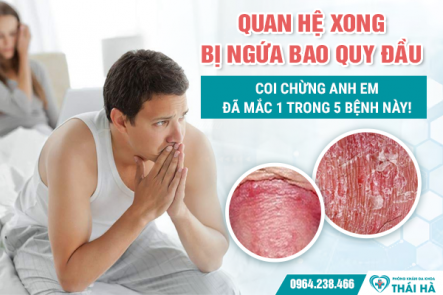 Quan Hệ Xong Bị Ngứa Bao Quy Đầu: Coi Chừng Anh Em Đã Mắc 1 Trong 5 Bệnh Này!
