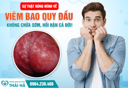 Sự Thật Rùng Mình Về Viêm Bao Quy Đầu: Không Chữa Sớm, Hối Hận Cả Đời!