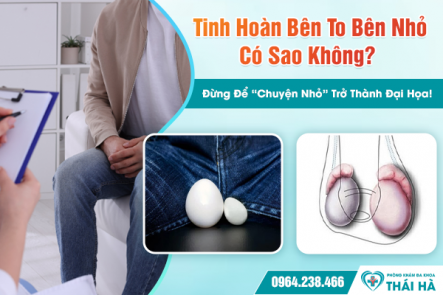 Tinh Hoàn Bên To Bên Nhỏ Có Sao Không? Đừng Để “Chuyện Nhỏ” Trở Thành Đại Họa!