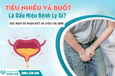 Tiểu Nhiều Và Buốt Là Dấu Hiệu Bệnh Lý Gì? Đọc Ngay Để Nhận Biết Và Chữa Trị Sớm!