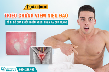 Báo động đỏ: Triệu chứng viêm niệu đạo dễ bị bỏ qua khiến nhiều người nhận ra quá muộn!