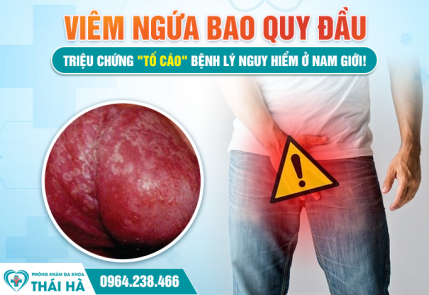 Viêm Ngứa Bao Quy Đầu: Triệu Chứng 