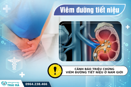 CẢNH BÁO TRIỆU CHỨNG VIÊM ĐƯỜNG TIẾT NIỆU Ở NAM GIỚI