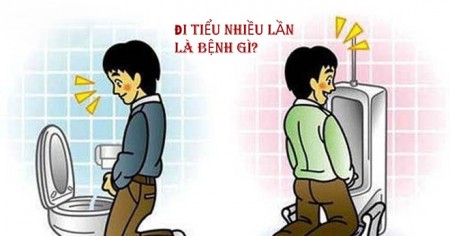 Đi tiểu nhiều lần trong ngày là bệnh gì?