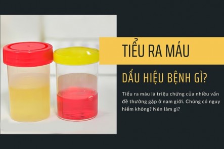 Đi tiểu ra máu là bệnh gì?