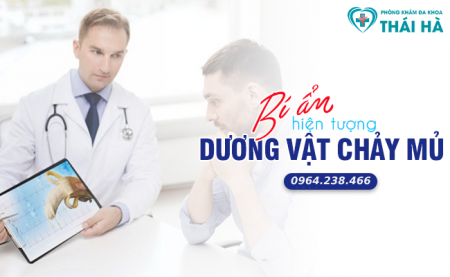 Bí ẩn đằng sau hiện tượng dương vật chảy mủ ở nam giới