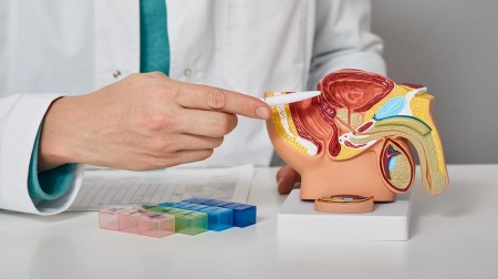 CÁCH CHỮA TRỊ BỆNH VIÊM TUYẾN TIỀN LIỆT