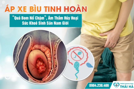 Áp Xe Bìu Tinh Hoàn: “Quả Bom Nổ Chậm”, Âm Thầm Hủy Hoại Sức Khoẻ Sinh Sản Nam Giới