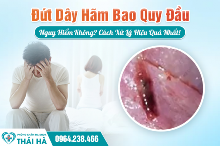 Đứt Dây Hãm Bao Quy Đầu: Nguy Hiểm Không? Cách Xử Lý Hiệu Quả Nhất!