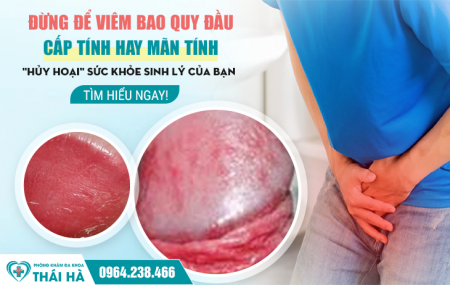 Đừng Để Viêm Bao Quy Đầu Cấp Tính Hay Mãn Tính 